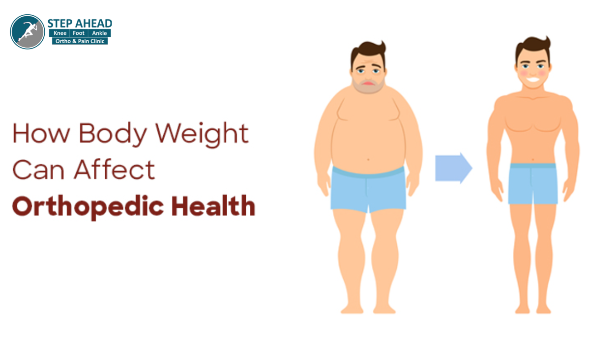 The Role of Weight Management in Treating Orthopedic Conditions