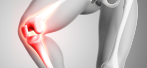 best knee expert in wakad