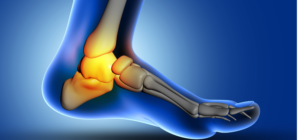 best ankle specialist in wakad