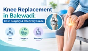 Knee Replacement in Balewadi: Cost, Surgery & Recovery Guide